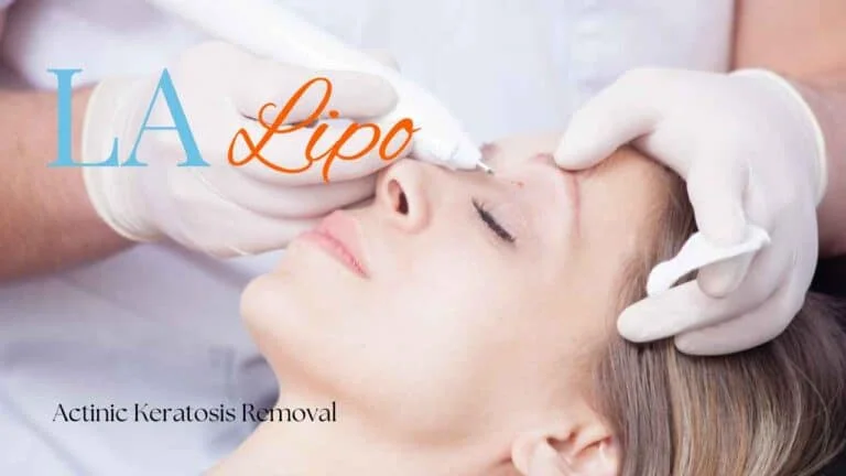 Woman receiving Actinic Keratosis Removal Treatment Stoke-upon-Trent
