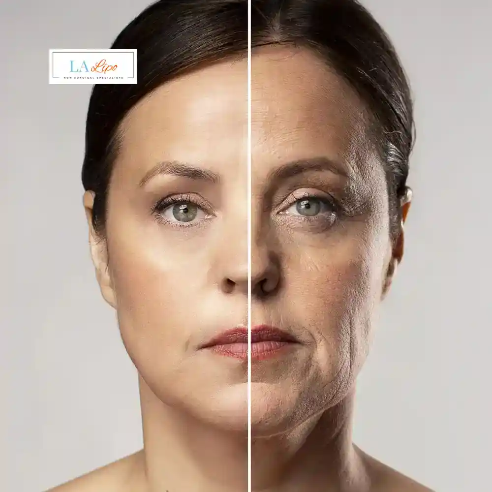 How Can You Tell If Non-Surgical Skin Tightening Is Right for You Stoke-upon-Trent?