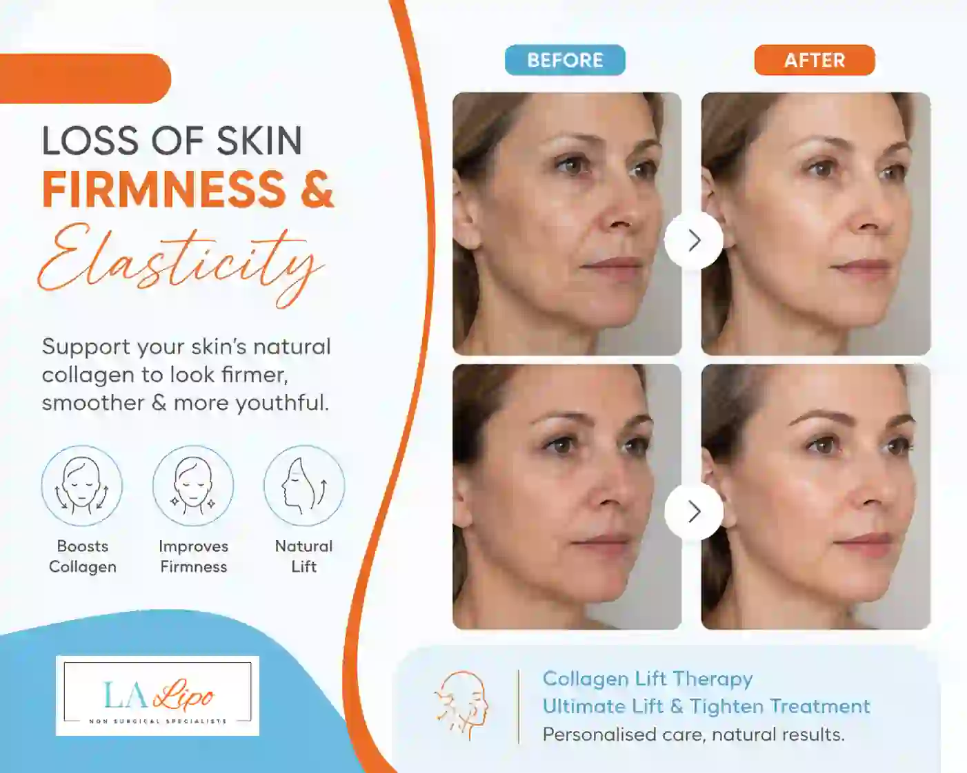 Sign #7: Loss of Skin Firmness and Elasticity Stoke-upon-Trent